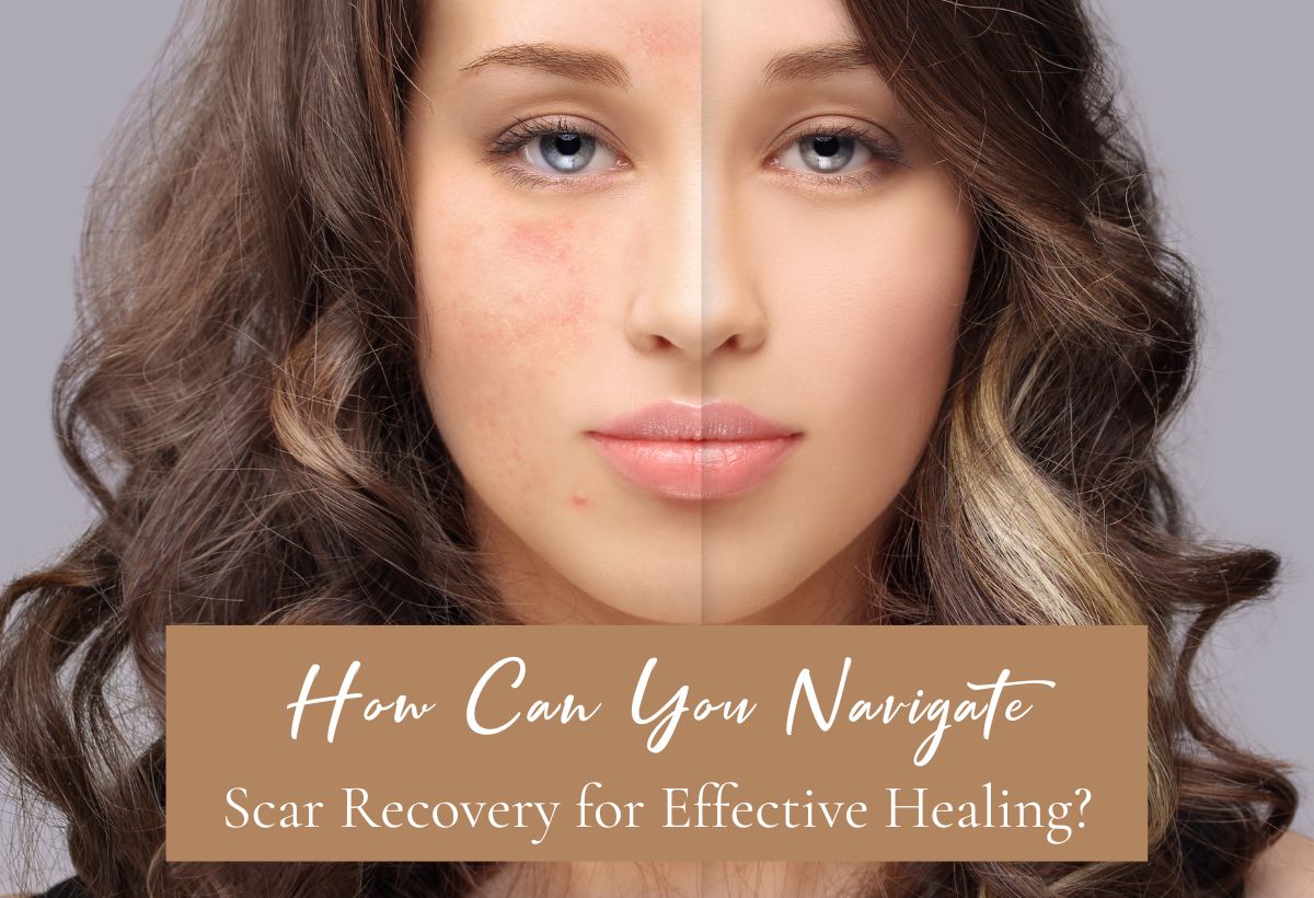 Navigate Scar Recovery
